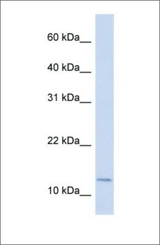 Anti-CRABP2 antibody produced in rabbit