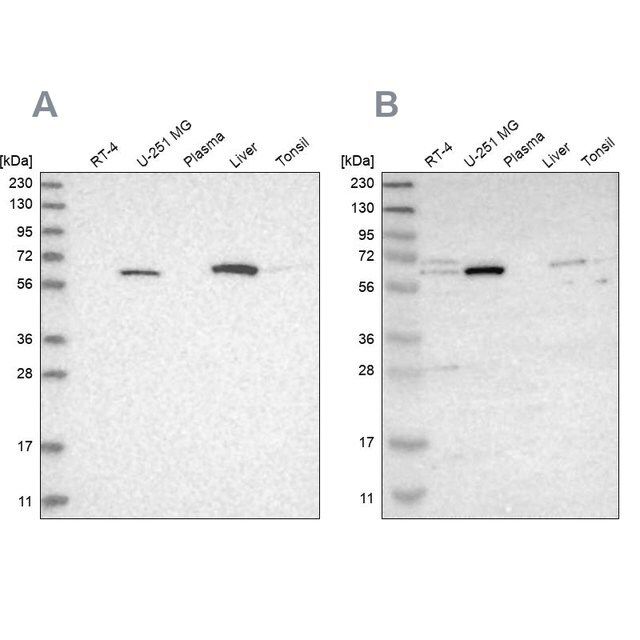 Anti-CRAT antibody produced in rabbit