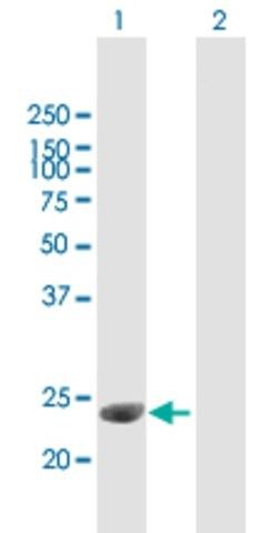 Anti-C1QTNF3 antibody produced in mouse