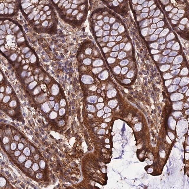 Anti-CRTAP antibody produced in rabbit