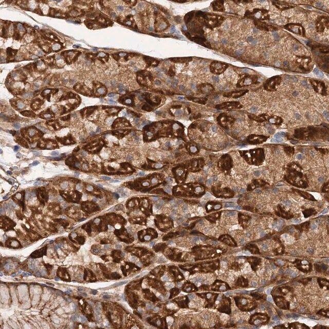 Anti-CSAD antibody produced in rabbit