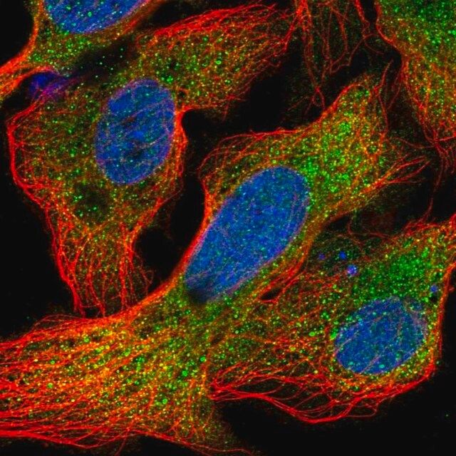 Anti-CRYAA antibody produced in rabbit