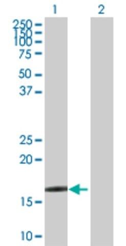 Anti-CRYGD antibody produced in rabbit