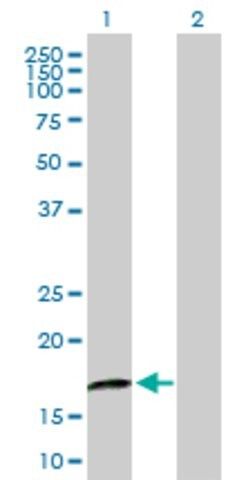 Anti-CRYGD antibody produced in mouse