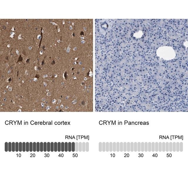 Anti-CRYM antibody produced in rabbit