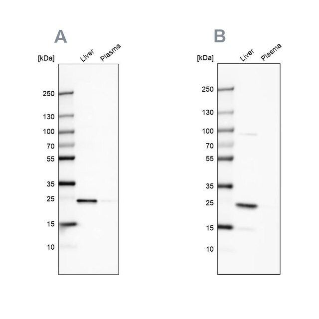 Anti-CRP antibody produced in rabbit
