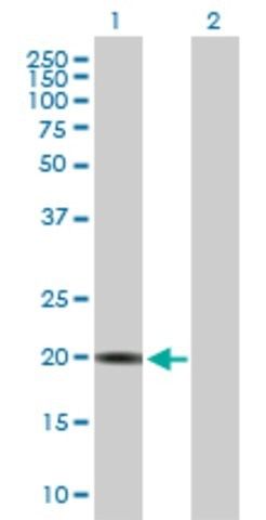 Anti-CRYGS antibody produced in mouse