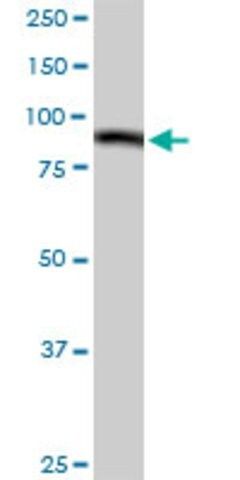 Anti-C1S antibody produced in rabbit
