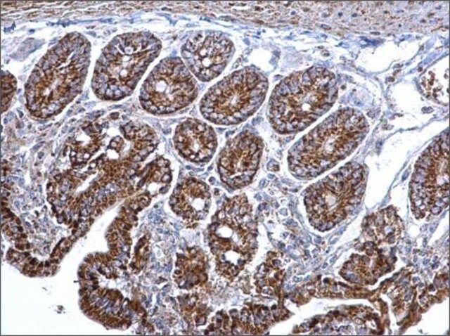 Anti-CS antibody produced in rabbit