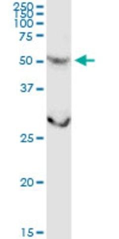 Anti-CSGALNACT2 antibody produced in rabbit