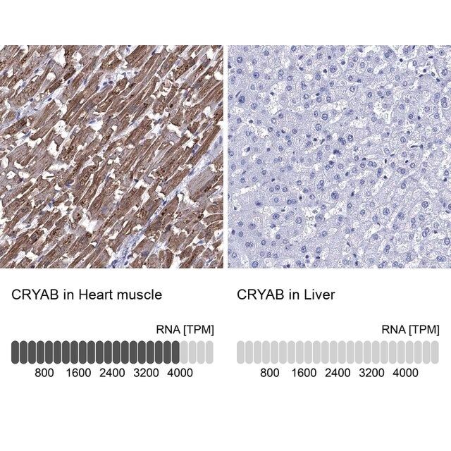 Anti-CRYAB antibody produced in rabbit