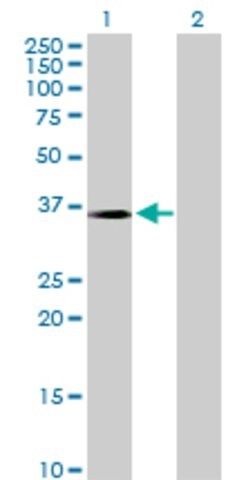 Anti-CRYM antibody produced in rabbit