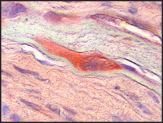 Anti-CSF1 antibody produced in rabbit
