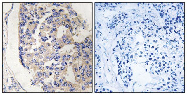 Anti-C1S, C-Terminal antibody produced in rabbit