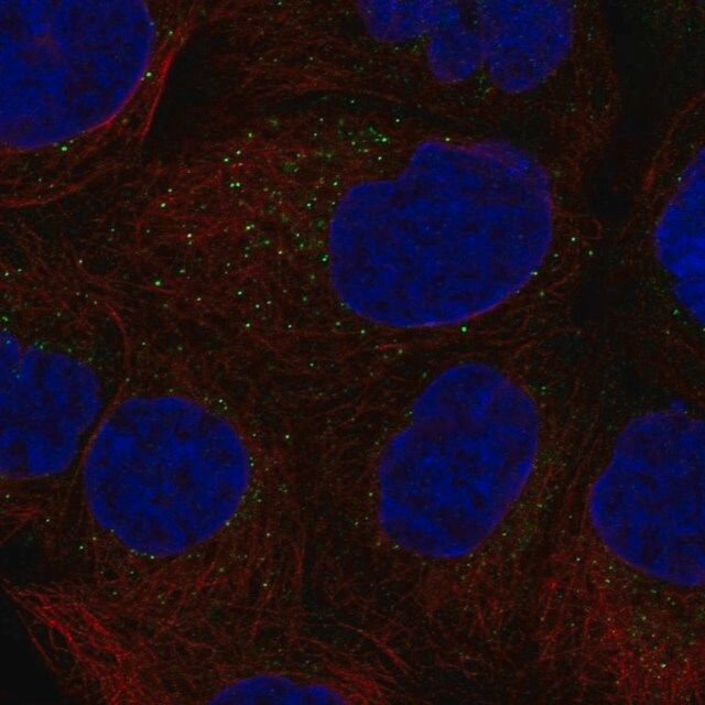 Anti-CSF2 antibody produced in rabbit