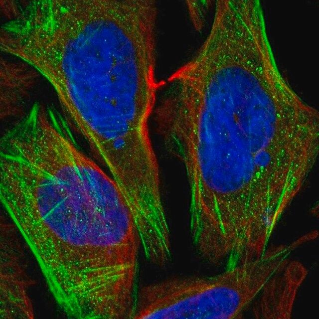 Anti-CSGALNACT1 antibody produced in rabbit
