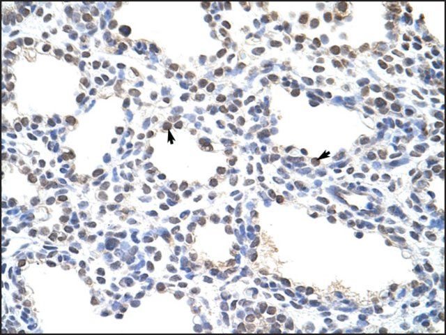 Anti-CSDC2 antibody produced in rabbit