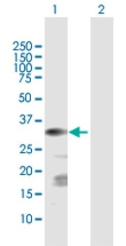 Anti-CSGALNACT1 antibody produced in rabbit