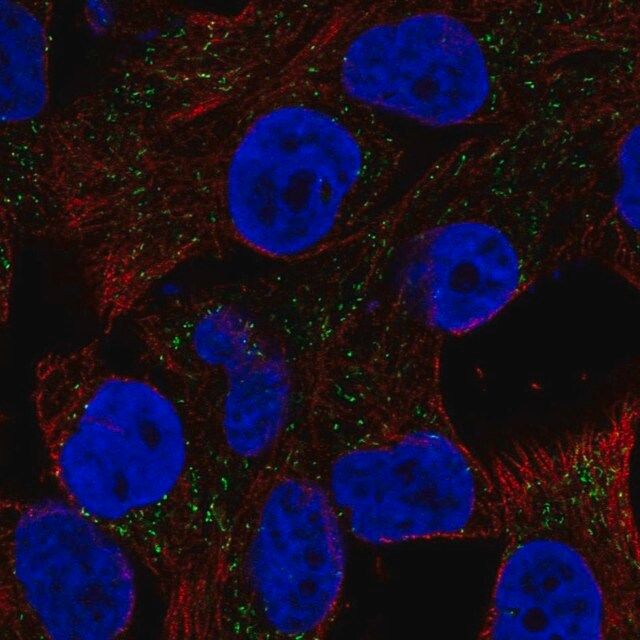Anti-CSAG1 antibody produced in rabbit