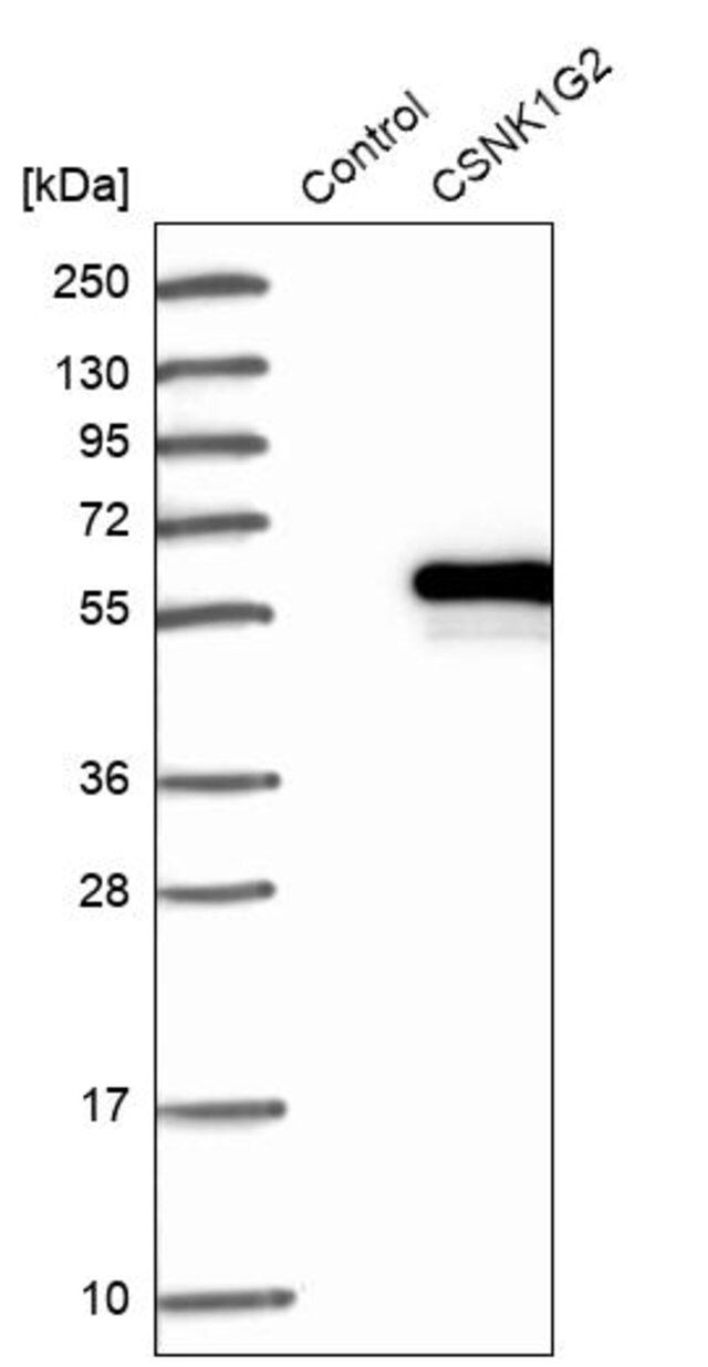 Anti-CSNK1G2 antibody produced in rabbit