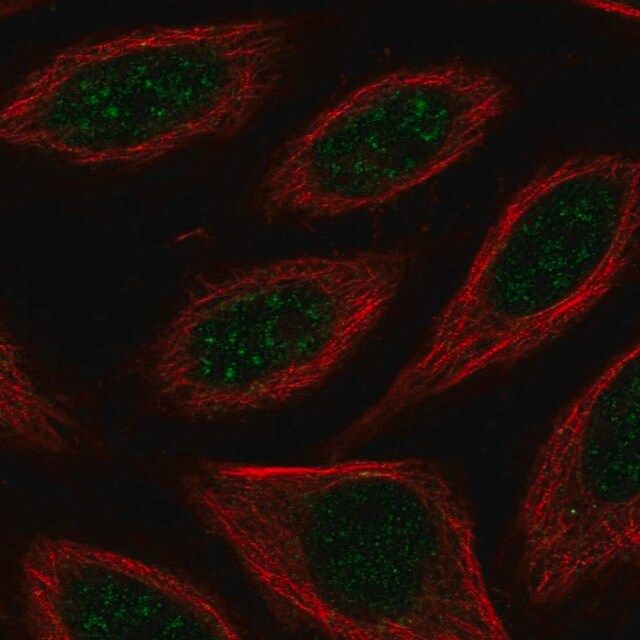 Anti-CSRNP2 antibody produced in rabbit