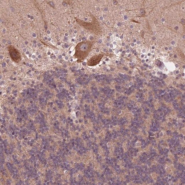 Anti-CSNK1G2 antibody produced in rabbit