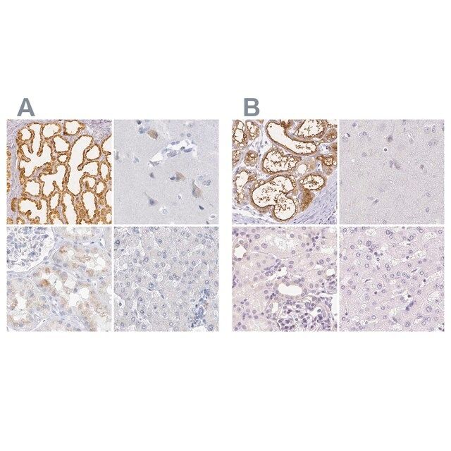 Anti-CSN1S1 antibody produced in rabbit