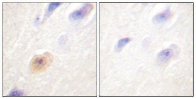 Anti-CSE1L antibody produced in rabbit
