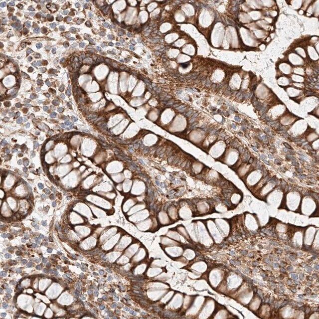 Anti-CSGALNACT2 antibody produced in rabbit