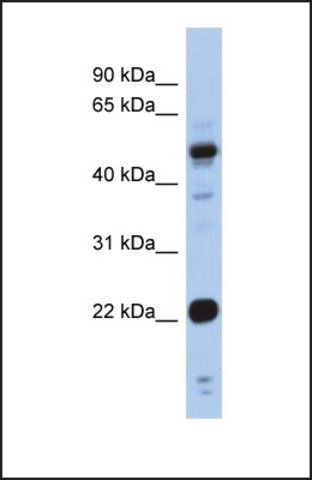 Anti-CSRP1 antibody produced in rabbit