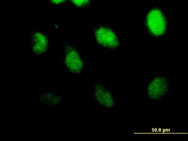 Anti-CSPG6 antibody produced in mouse