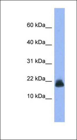 Anti-CST6 antibody produced in rabbit