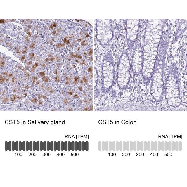 Anti-CST5 antibody produced in rabbit