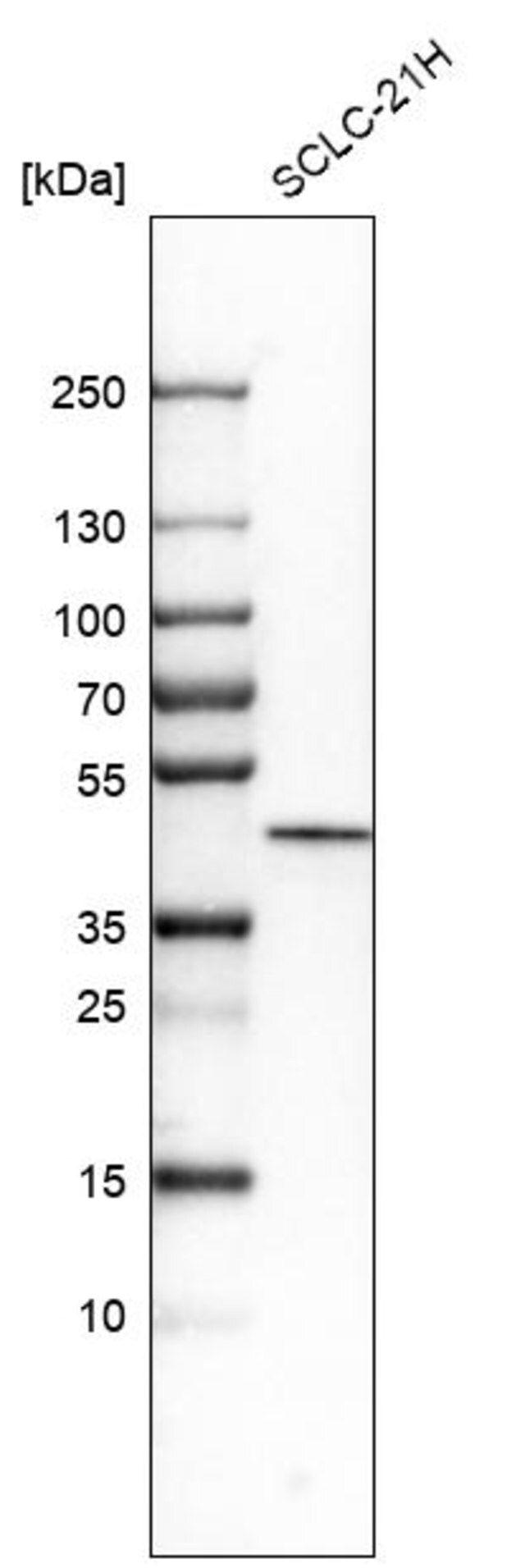 Anti-CSNK1E antibody produced in rabbit