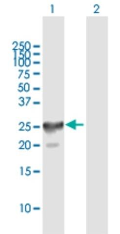 Anti-CT45-4 antibody produced in mouse