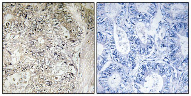 Anti-CST1 antibody produced in rabbit