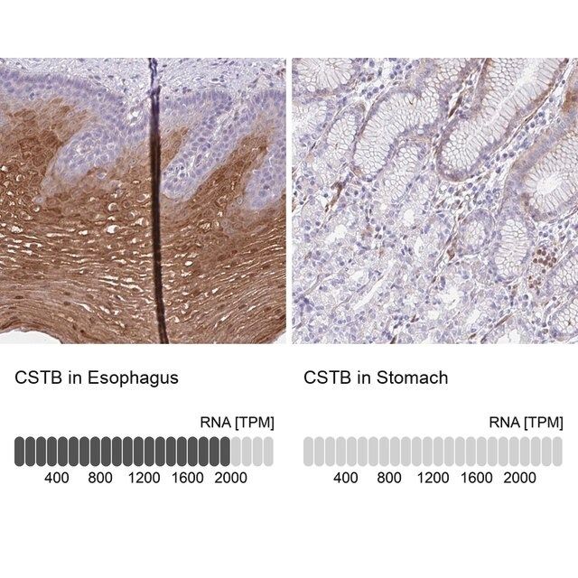 Anti-CSTB antibody produced in rabbit