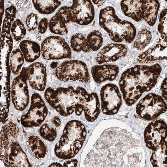 Anti-CST9 antibody produced in rabbit