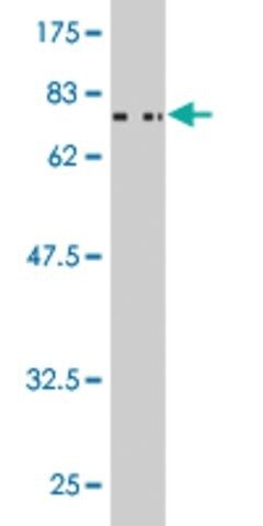 ANTI-CSNK1G2 antibody produced in mouse