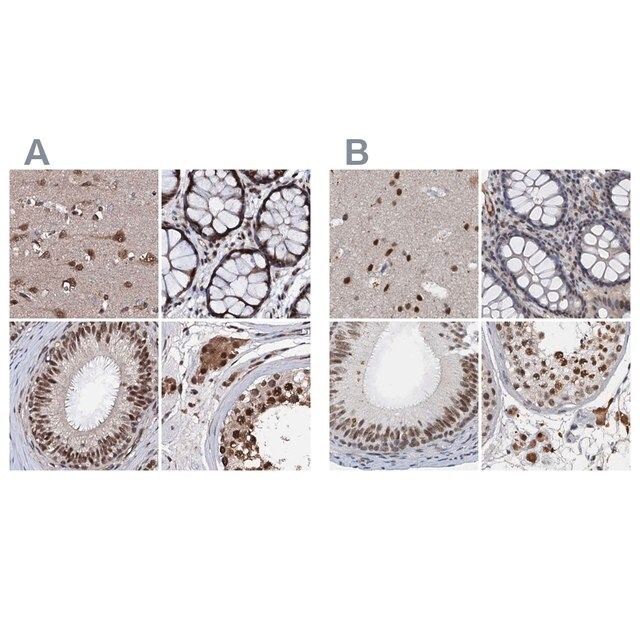 Anti-CSTF3 antibody produced in rabbit