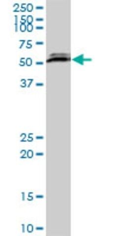 Anti-CSTF2T antibody produced in mouse