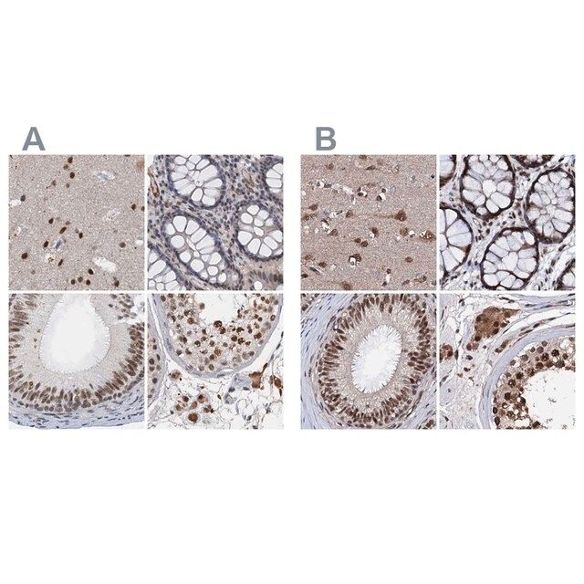 Anti-CSTF3 antibody produced in rabbit