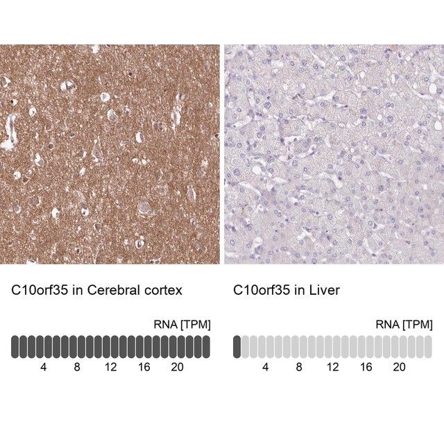 Anti-C10orf35 antibody produced in rabbit
