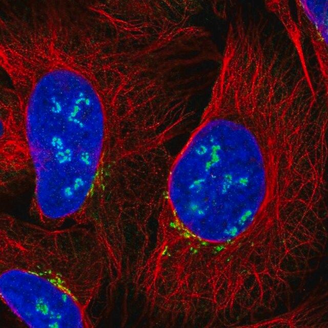 Anti-C12orf43 antibody produced in rabbit