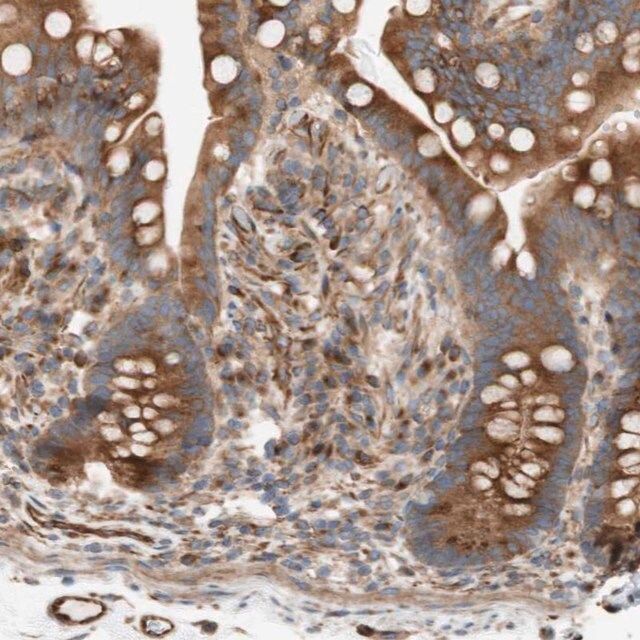 Anti-C1orf43 antibody produced in rabbit