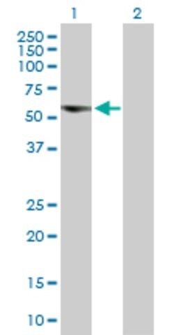 Anti-C17ORF57 antibody produced in mouse