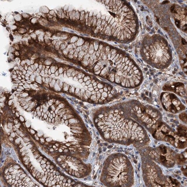 Anti-C14orf80 antibody produced in rabbit