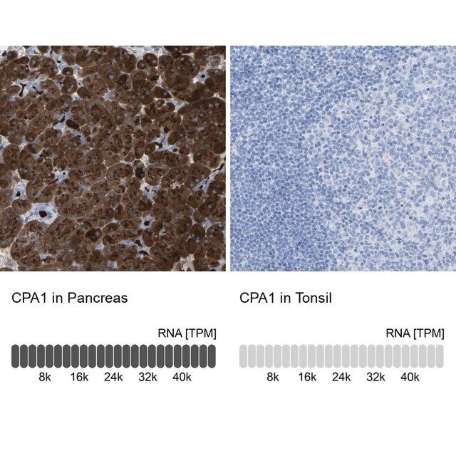 Anti-CPA1 antibody produced in rabbit
