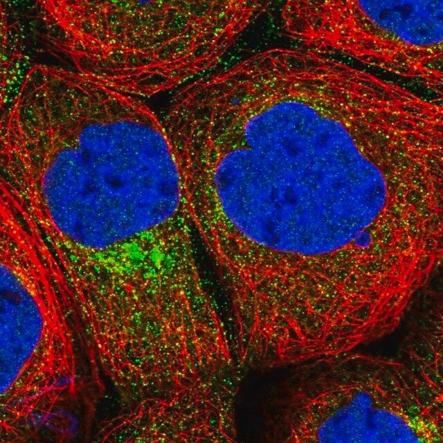 Anti-CPEB4 antibody produced in rabbit