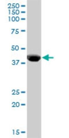 Anti-CPB1 antibody produced in mouse